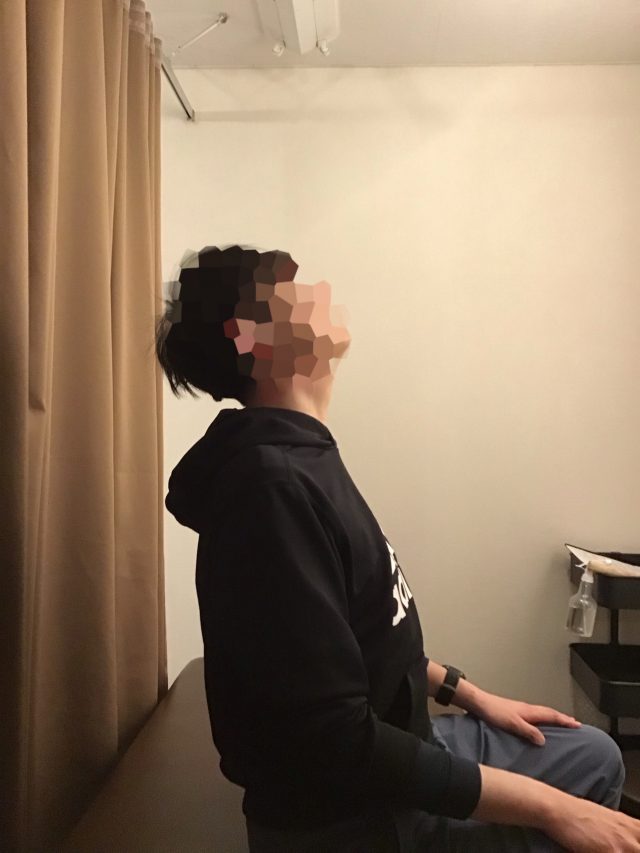 after画像