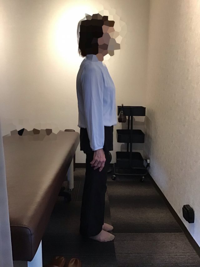 after画像