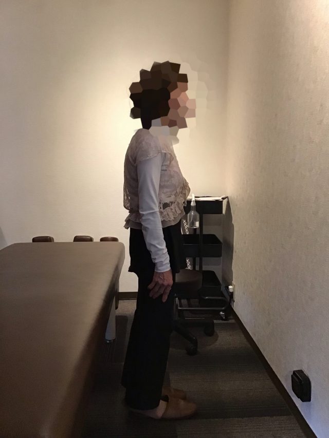 before画像